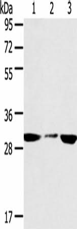 Anti-Human/Mouse/Rat SDHB Antibody - ABMIUM