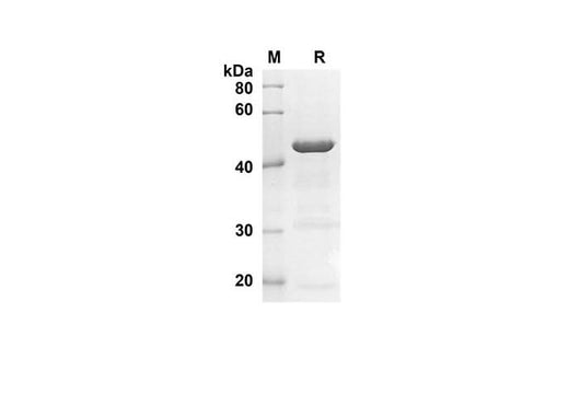 SDS-PAGE analysis of Human LGALS7 proteins, 2 μg/lane of Recombinant Human LGALS7 proteins was resolved with SDS-PAGE under reducing conditions, showing bands at 30.8 kDa.