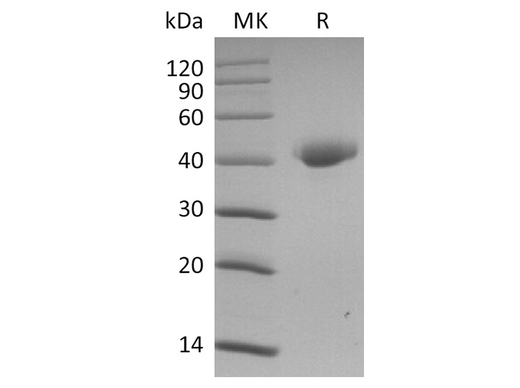 Recombinant SARS-CoV-2 Spike Protein, Biotinylated (RBD-SD1, Avi-His Tag) - ABMIUM