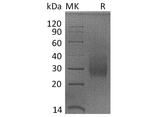Recombinant Rhesus macaque HVEM/TNFRSF14/CD270 Protein (His Tag) - ABMIUM