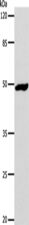 Anti-Human DRD1 Antibody - ABMIUM