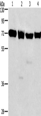 Anti-Human IL2RB Antibody - ABMIUM