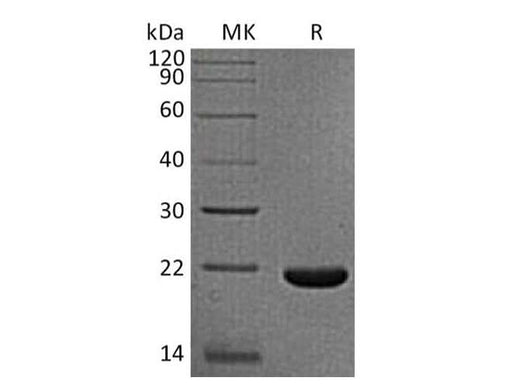 Recombinant Rhesus macaque IL-33/Interleukin-33 Protein (His Tag) - ABMIUM