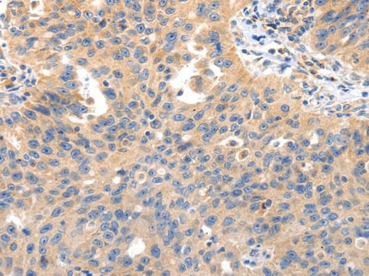 Anti-Human/Mouse IRS2 Antibody - ABMIUM