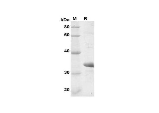SDS-PAGE analysis of Human Mfn2 proteins, 2 μg/lane of Recombinant Human Mfn2 proteins was resolved with SDS-PAGE under reducing conditions, showing bands at 34 kDa.