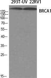 Anti-Human/Rat BRCA1 Antibody