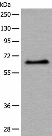 Western blot analysis of Hela cell lysate using ATF7 Polyclonal Antibody at dilution of 1:500