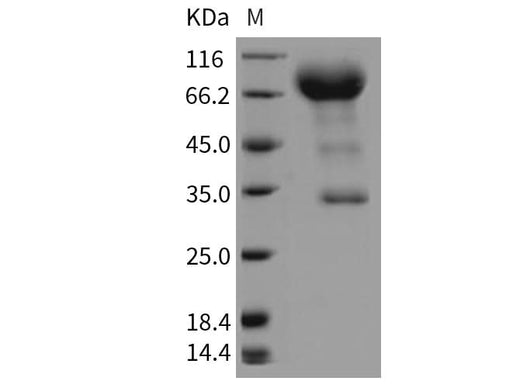 Recombinant Rat CD133/PROM1/Prominin 1 Protein (Fc Tag) - ABMIUM