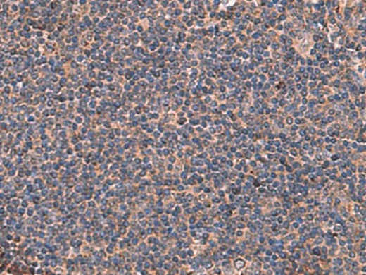 Immunohistochemistry of paraffin-embedded Human tonsil tissue using ITGA11 Polyclonal Antibody at dilution of 1:50(×200)