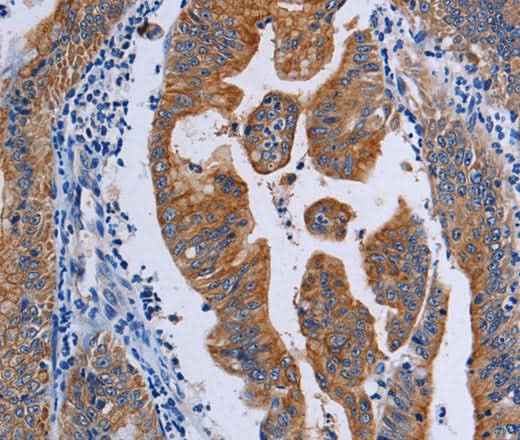 Anti-Human ACP6 Antibody