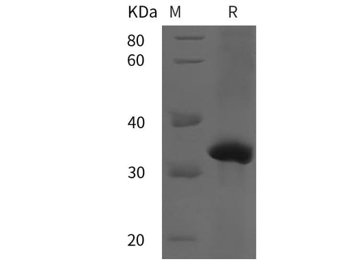 SDS-PAGE analysis of Human KLK3 proteins, 2 μg/lane of Recombinant Human KLK3 proteins was resolved with SDS-PAGE under reducing conditions, showing bands at 32 kDa.