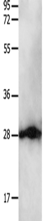 Anti-Human/Mouse/Rat YWHAB Antibody - ABMIUM