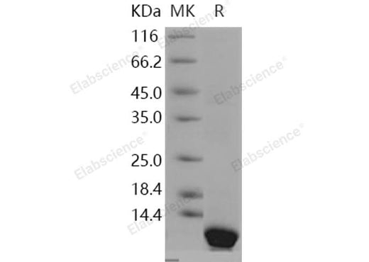 Recombinant Human Pepsinogen C/PGC Protein (E.coli, His Tag) - ABMIUM
