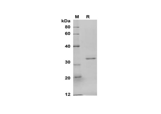 SDS-PAGE analysis of Human IL-4 proteins, 2 μg/lane of Recombinant Human IL-4 proteins was resolved with SDS-PAGE under reducing conditions, showing bands at 33 kDa.