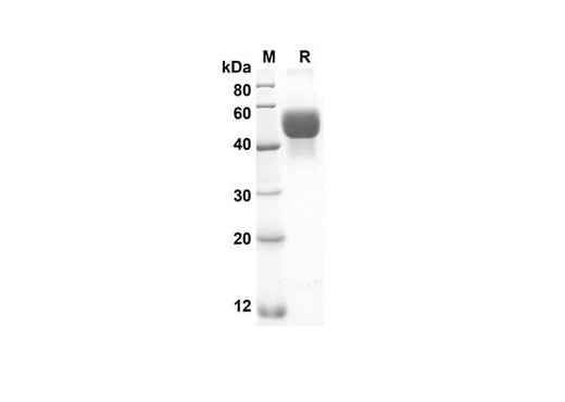 SDS-PAGE analysis of Rat HP proteins, 2 μg/lane of Recombinant Rat HP proteins was resolved with an SDS-PAGE under reducing conditions, showing bands at 38 kDa.