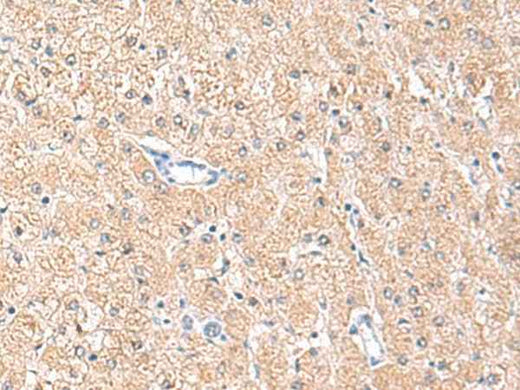 Anti-Human MLKL Antibody