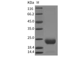 Recombinant Mouse CCDC47 Protein (His Tag) - ABMIUM
