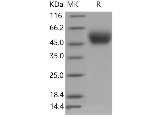 Recombinant Mouse PLAUR/uPAR Protein (His Tag) - ABMIUM