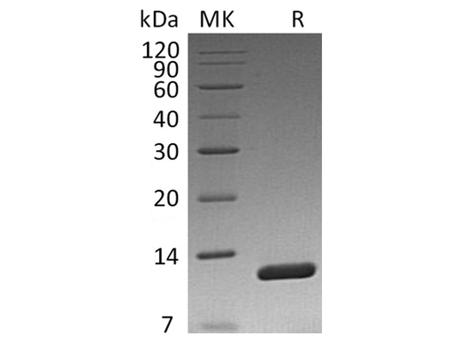 Recombinant Vibrio cholerae Toxin B Protein - ABMIUM