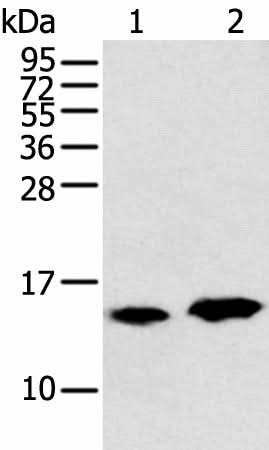 Western blot analysis of Rat heart tissue and Mouse brain tissue using CARTPT Polyclonal Antibody at dilution of 1:350