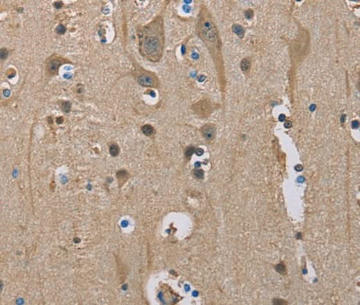 Anti-Human SERPINA1 Antibody - ABMIUM