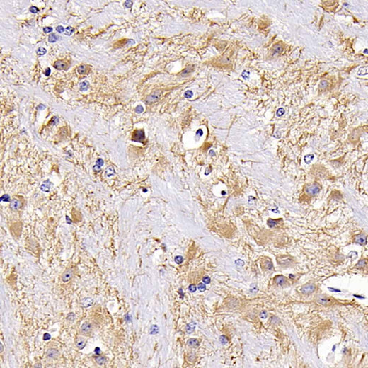 Immunohistochemistry analysis of paraffin-embedded mouse brain using MAP2 Polyclonal Antibody at dilution of 1:300.