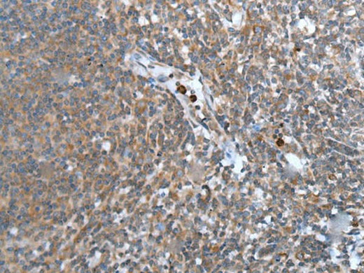 Immunohistochemistry of paraffin-embedded Human tonsil tissue using WISP2 Polyclonal Antibody at dilution of 1:45(×200)