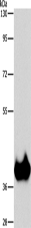 Anti-Human/Mouse/Rat ASPA Antibody - ABMIUM