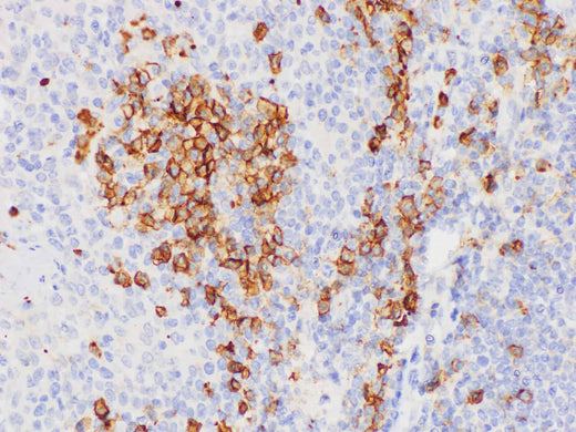 Immunohistochemistry of paraffin-embedded Human tonsil using CD38 Polycloanl Antibody at dilution of 1:200