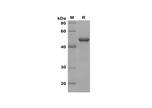 SDS-PAGE analysis of Human NOS2/INOS proteins, 2 μg/lane of Recombinant Human NOS2/INOS proteins was resolved with SDS-PAGE under reducing conditions, showing bands at 47 kDa.