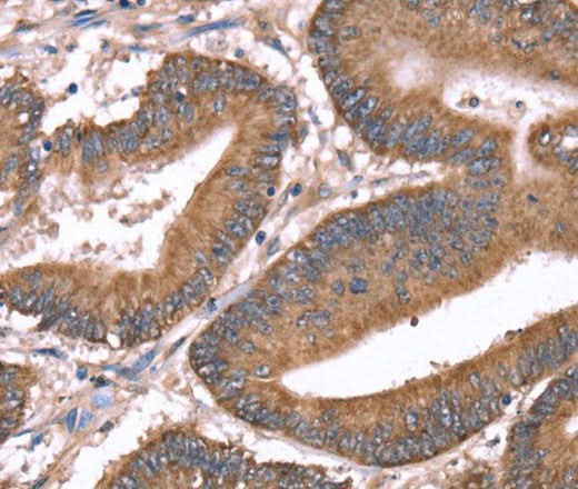 Anti-Human HRG Antibody