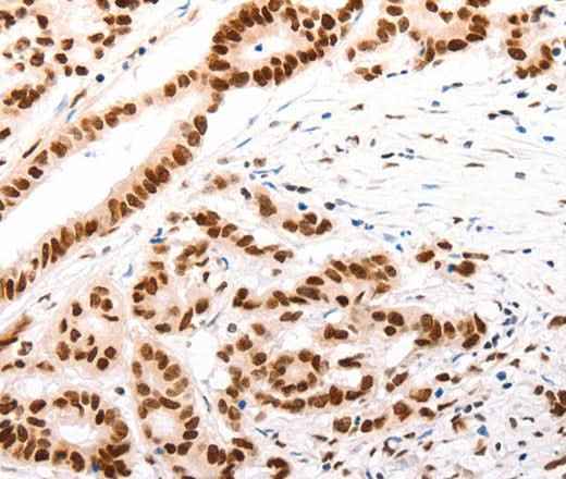 Anti-Human/Mouse CASP9 (active) Antibody