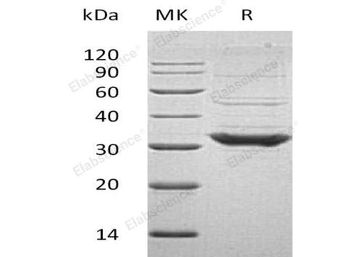 Recombinant Human TOLLIP Protein (His Tag) - ABMIUM