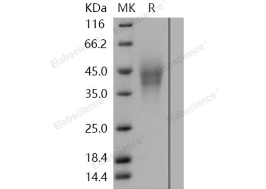 Recombinant Human LMIR2/CD300C Protein (His Tag) - ABMIUM