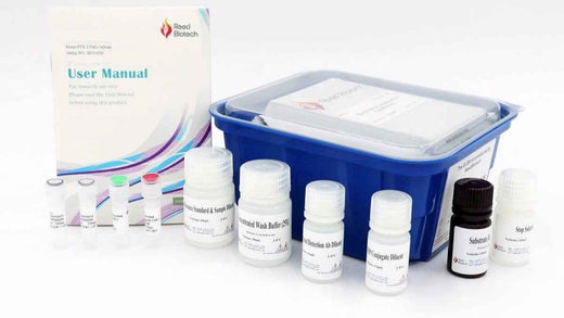 Rabbit Tyk-2(Tyrosine Kinase 2) ELISA Kit