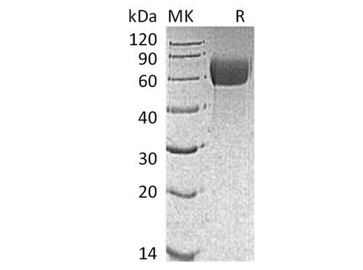 Recombinant Mouse IL13RA1 Protein (AVI & His Tag) - ABMIUM