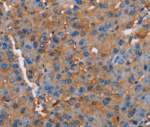 Anti-Human NLGN1 Antibody - ABMIUM
