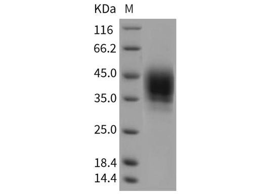 Recombinant Rat CD48 Protein (His Tag) - ABMIUM