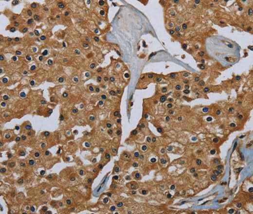 Anti-Human GBP5 Antibody