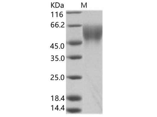 Recombinant EBOV (subtype Zaire, strain Mayinga 1976) GP-RBD / Glycoprotein Protein - ABMIUM