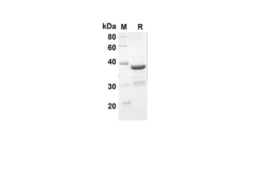 SDS-PAGE analysis of Rat Cxcl2 proteins, 2 μg/lane of Recombinant Rat Cxcl2 proteins was resolved with an SDS-PAGE under reducing conditions, showing bands at 33.6 kDa.