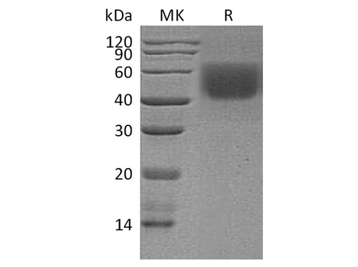 Recombinant Human CD86/B7-2 Protein (Val185Ile, His Tag) - ABMIUM