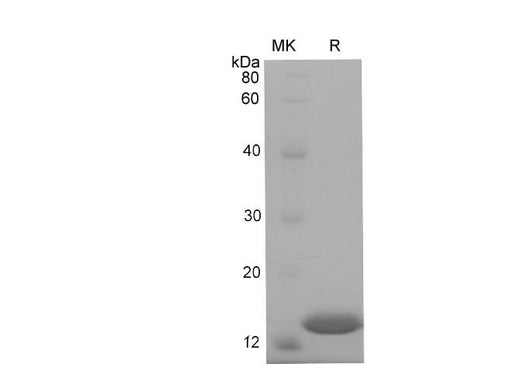 SDS-PAGE analysis of Mouse RBP1 proteins, 2 μg/lane of Recombinant Mouse RBP1 proteins was resolved with SDS-PAGE under reducing conditions, showing bands at 17 kDa.