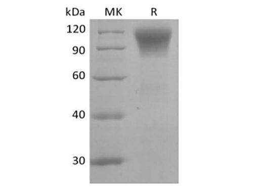 Recombinant Human CD45R0 (C-6His) - ABMIUM
