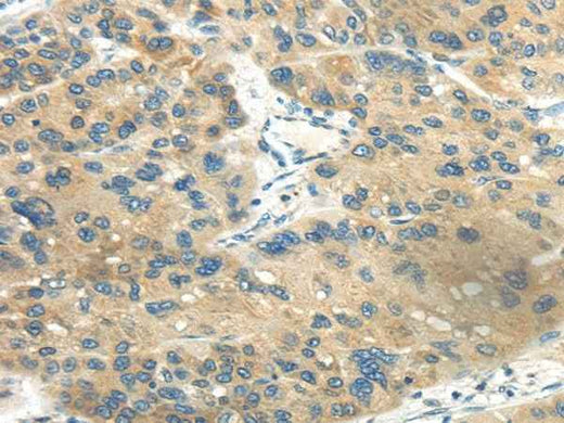 Anti-Human CD70 Antibody