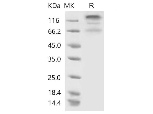 Recombinant SARS-CoV-2 S1+S2 Protein (ECD, His Tag) - ABMIUM