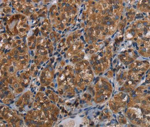 Anti-Human LLGL1 Antibody