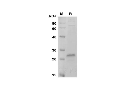 SDS-PAGE analysis of Human VEGF proteins, 2 μg/lane of Recombinant Human VEGF proteins was resolved with SDS-PAGE under reducing conditions, showing bands at 18-24 kDa.