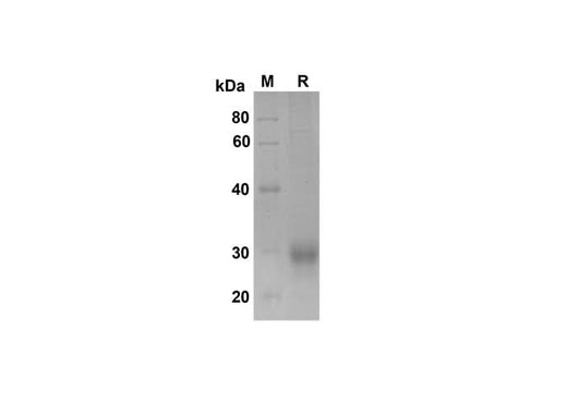 SDS-PAGE analysis of Human Fcγ RIIB/CD32b proteins , 2 μg/lane of Recombinant Human Fcγ RIIB/CD32b proteins was resolved with SDS-PAGE under reducing conditions , showing bands at 30 kDa.