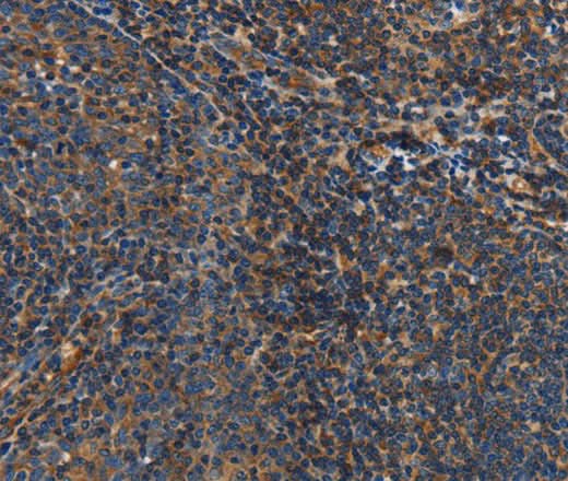Anti-Human IL17D Antibody